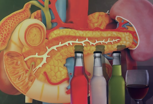 Поджелудочная железа и алкоголь